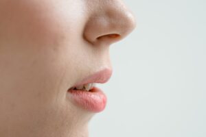 Rinoplastia (remodelarea nasului) 