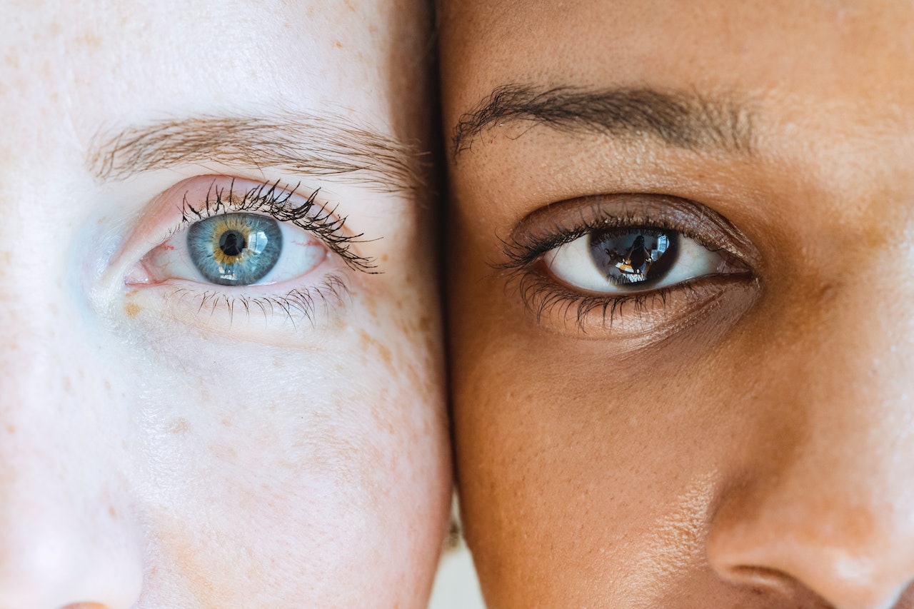 Read more about the article Blefaroplastia (chirurgia pleoapelor) 