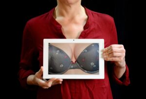 Mastopexia – liftingul (ridicarea) sânilor 